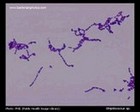 streptococcus gram stained